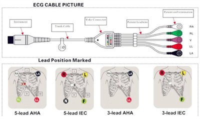 Kif tikkonnettja sew il-kejbil ECG b'leawires ma' monitor tal-pazjent?